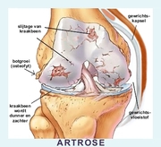 Artrose bij honden