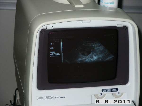 Of The New Born Beauty,s