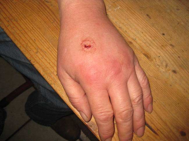 een eenvoudige honden bijt