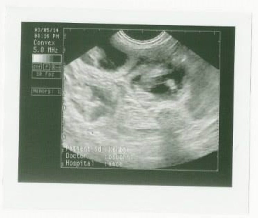 Echo van onze toekomstige pup (ergens haha)